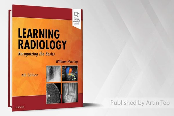 2024 Learning Radiology Recognizing the Basics – William Herring – 4th Edition