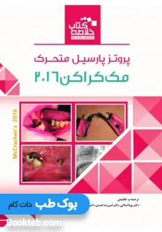 Book Brief خلاصه کتاب پروتز پارسیل متحرک مک کراکن 2016