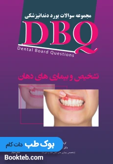 DBQ تشخیص و بیماری های دهان