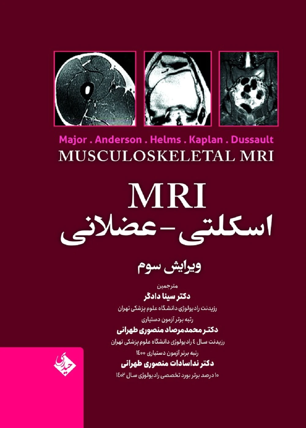 MRI اسکلتی – عضلانی
