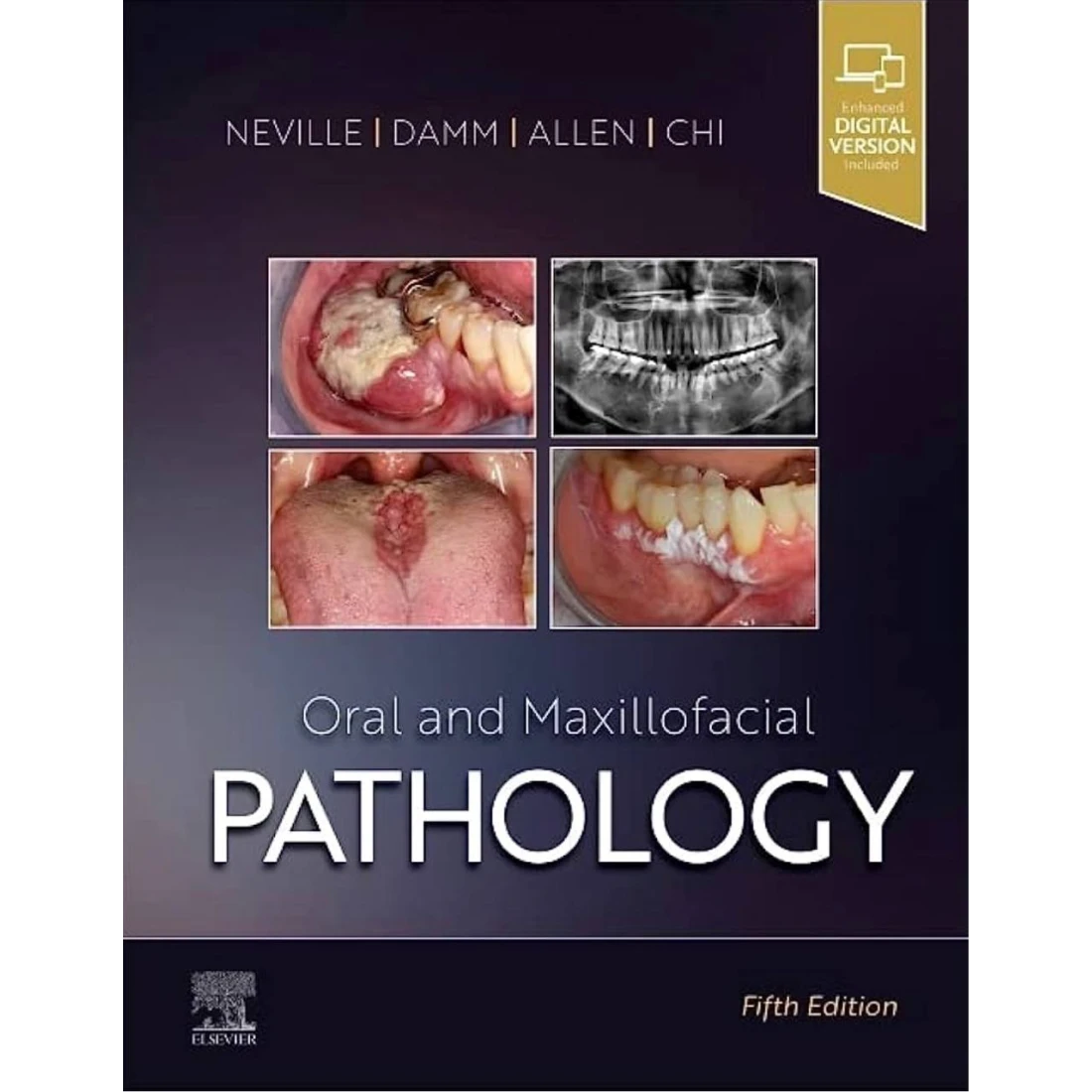 Oral and Maxillofacial Pathology 5th Edition (NEVILLE) 2024