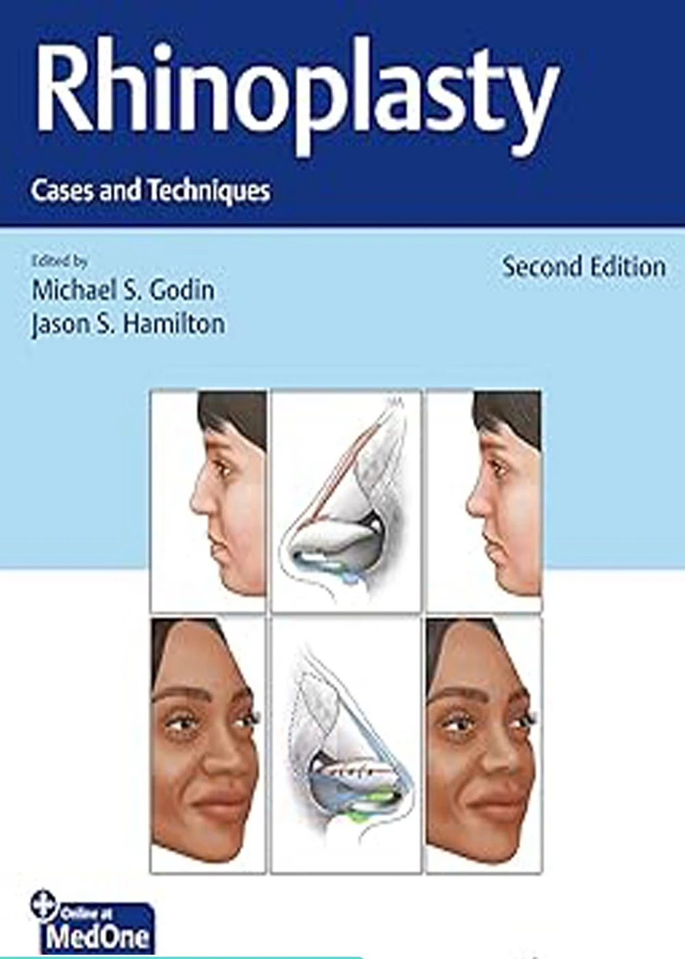 Rhinoplasty Cases and Techniques 2nd Edition رینوپلاستی موارد و تکنیک ها ویرایش دوم
