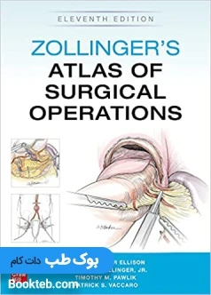 Zollinger’s Atlas of Surgical Operations