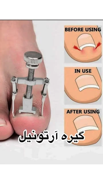 آرتونیل