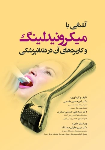 آشنایی با میکرونیدلینگ و کاربردهای آن در دندانپزشکی
