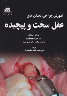 آموزش جراحی دندان های عقل سخت و پیچیده