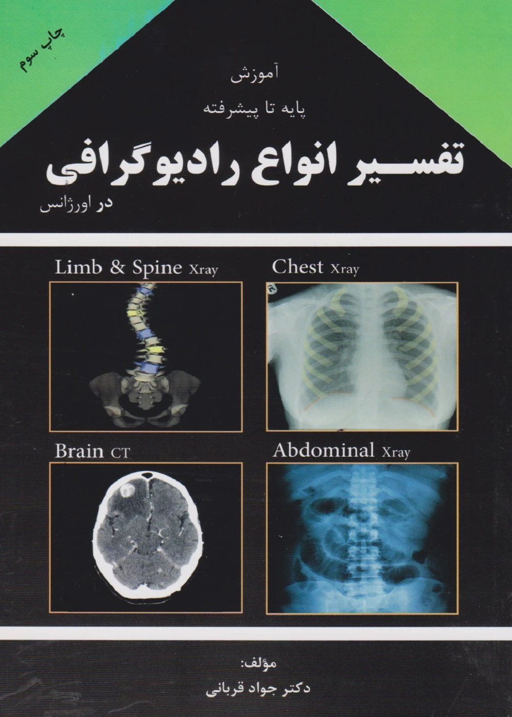آموزش پایه تا پیشرفته تفسیر انواع رادیوگرافی در اورژانس