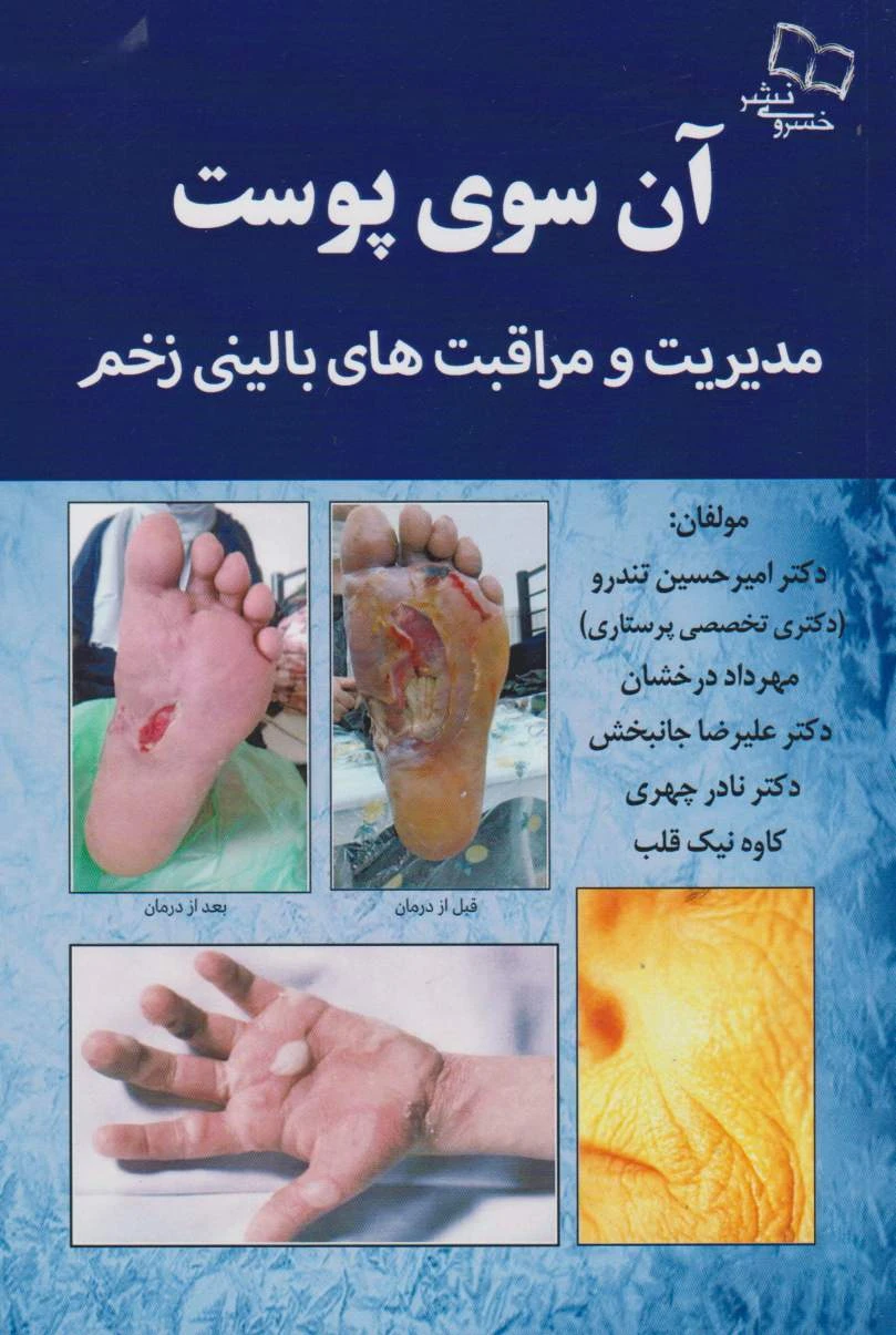 آن سوی پوست مدیریت و مراقبت های بالینی زخم