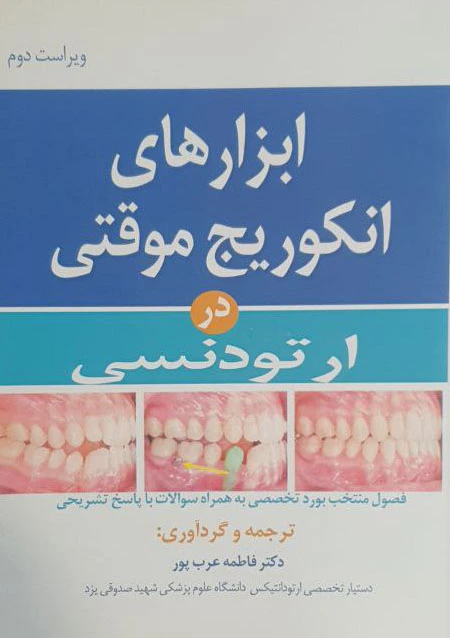 ابزارهای انکوریج موقتی در ارتودنسی