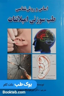 اساس و روش‌شناسی طب سوزنی امپلانتات