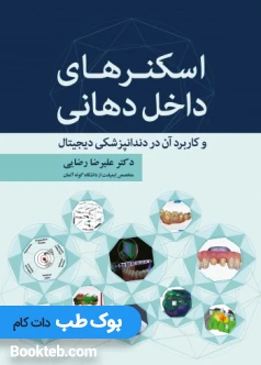 اسکنرهای داخل دهانی و کاربرد آن در دندانپزشکی دیجیتال