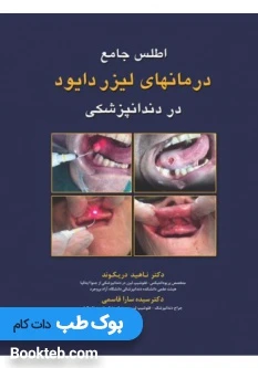 اطلس جامع درمان های لیزر دایود در دندانپزشکی