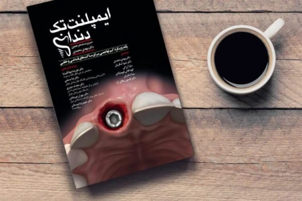 ایمپلنت تک دندان( یک رویکرد کم تهاجمی برای ساکت های قدامی و خلفی)