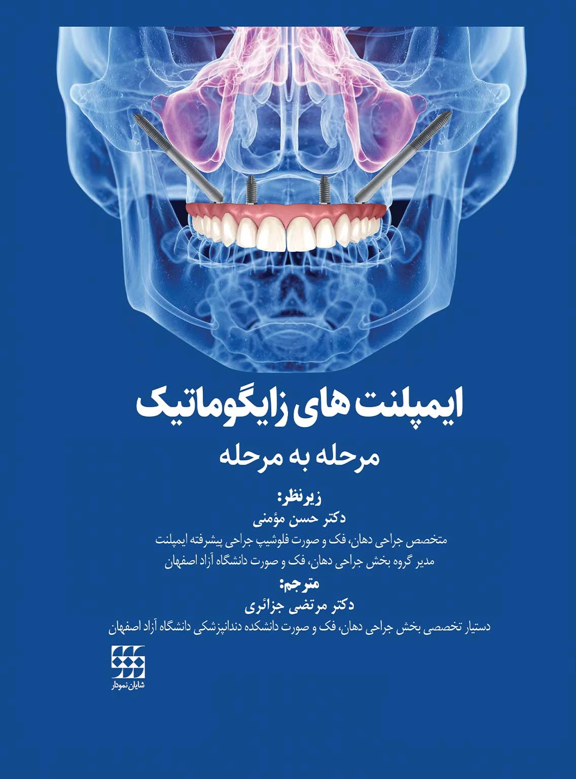 ایمپلنت های زایگوماتیک (مرحله به مرحله)