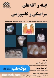 اینله و آنله های سرامیکی و کامپوزیتی