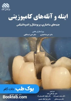 اینله و آنله های کامپوزیتی