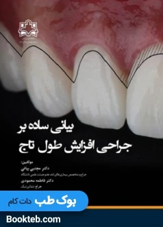بیانی ساده بر جراحی افزایش طول تاج