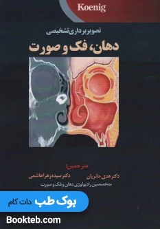 تصویر برداری تشخیصی دهان فک و صورت – koenig