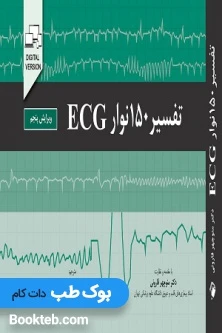 تفسیر 150 نوار ECG