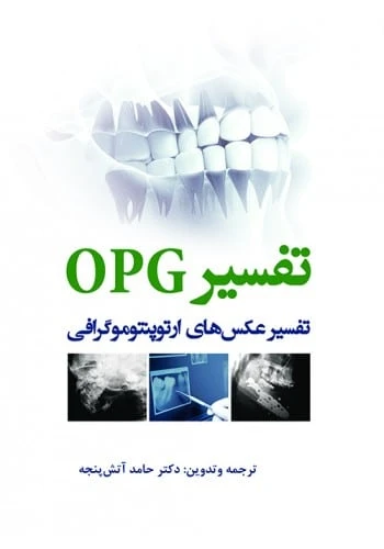 تفسیر OPG تفسیر عکس‌های ارتوپنتوموگرافی