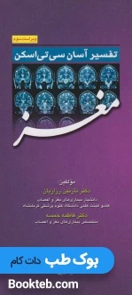 تفسیر آسان سی تی اسکن مغز