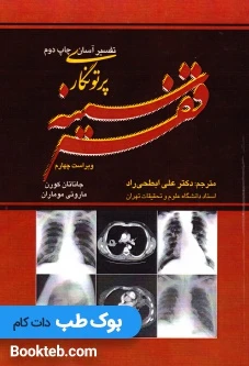 تفسیر آسان پرتونگاری قفسه سینه