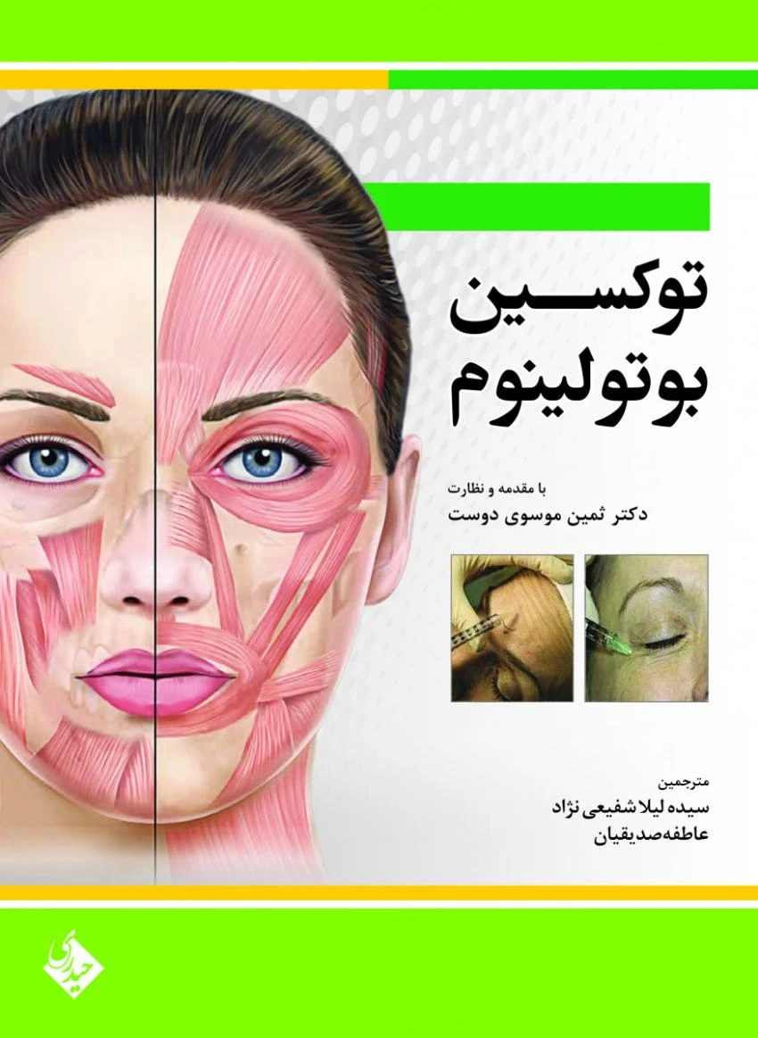 توکسین بوتولینوم