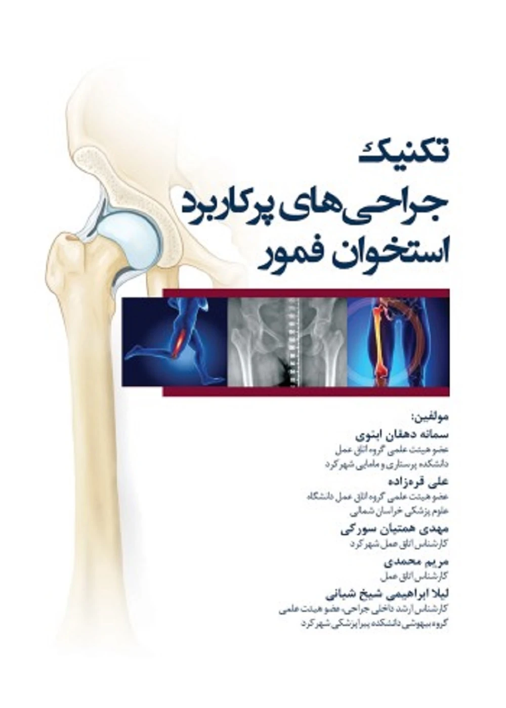 تکنیک جراحی های پرکاربرد استخوان فمور