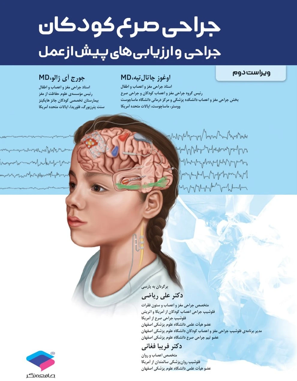 جراحی صرع کودکان جراحی و ارزیابی‌های پیش از عمل