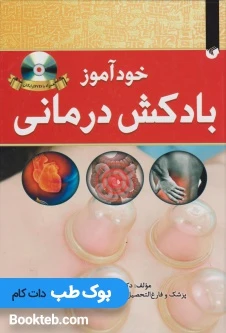 خودآموز بادکش درمانی