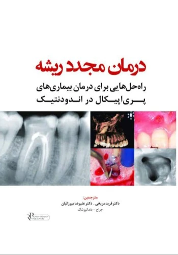 درمان مجدد ریشه راه حل هایی برای درمان بیماری های پری اپیکال در اندودنتیک