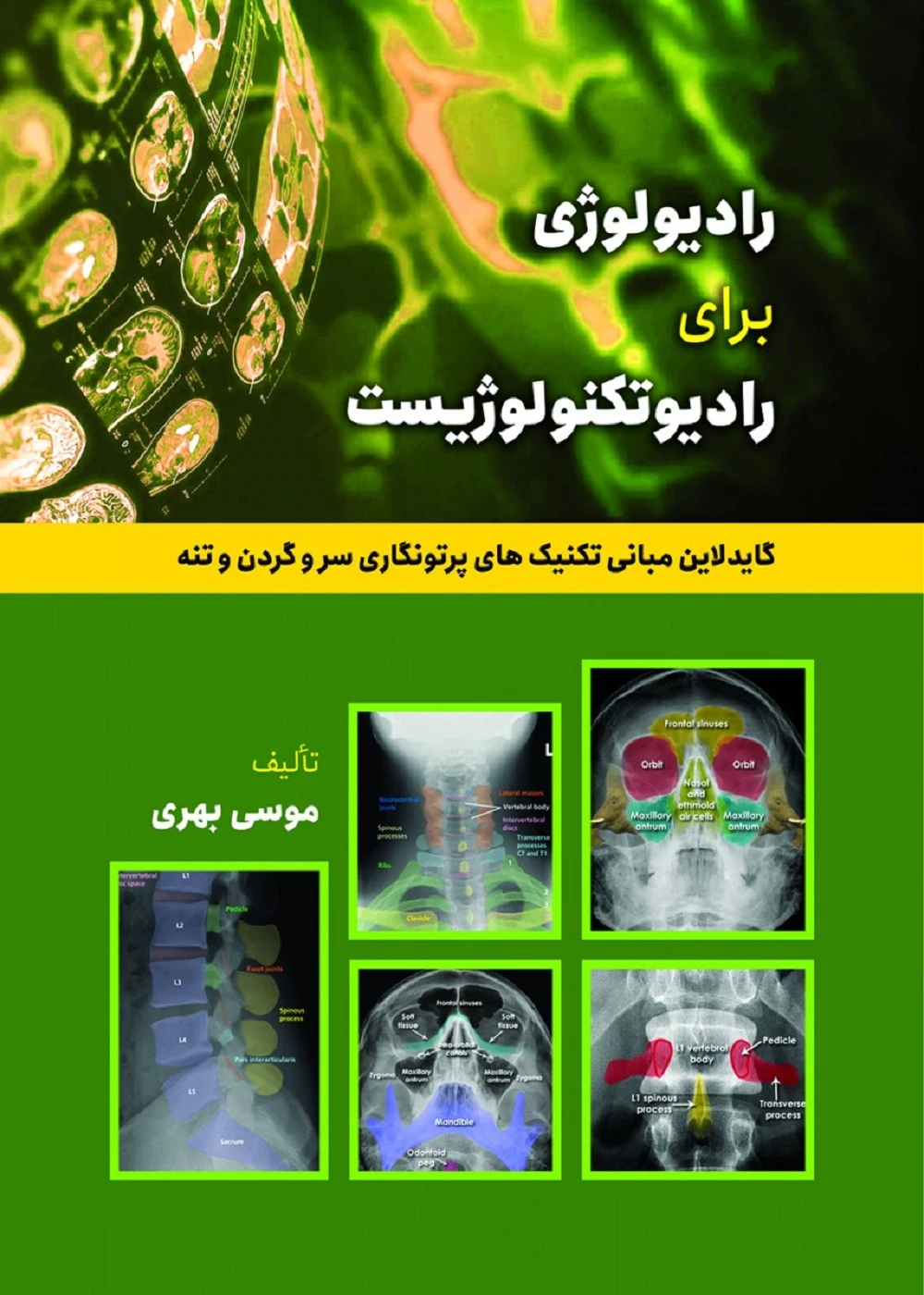 رادیولوژی برای رادیوتکنولوژیست (گایدلاین تکنیک های پرتونگاری استخوان های سر و گردن و تنه)