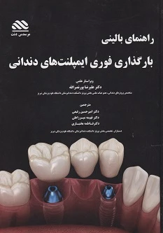 راهنمای بالینی بارگذاری فوری ایمپلنت های دندانی