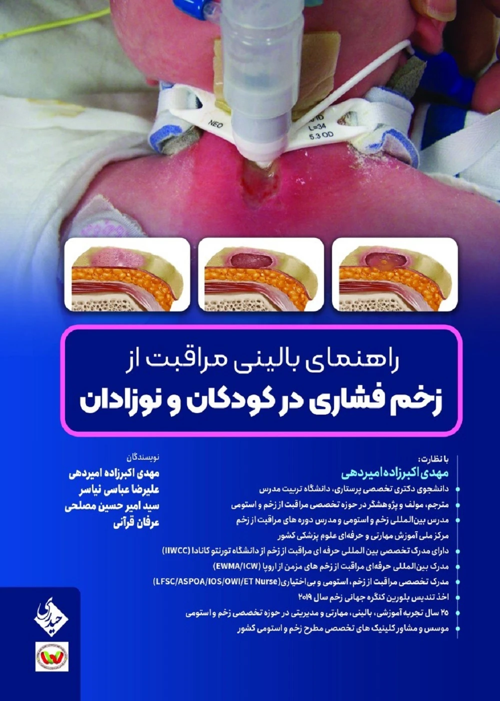 راهنمای بالینی مراقبت از زخم فشاری در کودکان و نوزادان