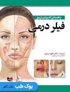 راهنمای کاربردی تزریق فیلر درمی