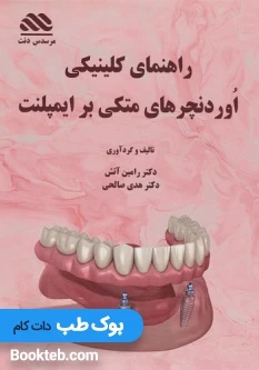 راهنمای کلینیکی اوردنچرهای متکی بر ایمپلنت