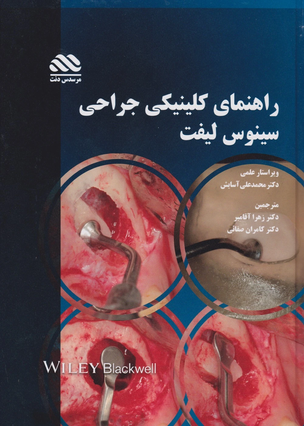 راهنمای کلینیکی جراحی سینوس لیفت
