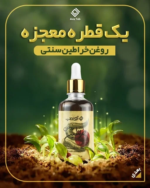 🍾روغن حجم دهنده خراطین آوطب 🪱
