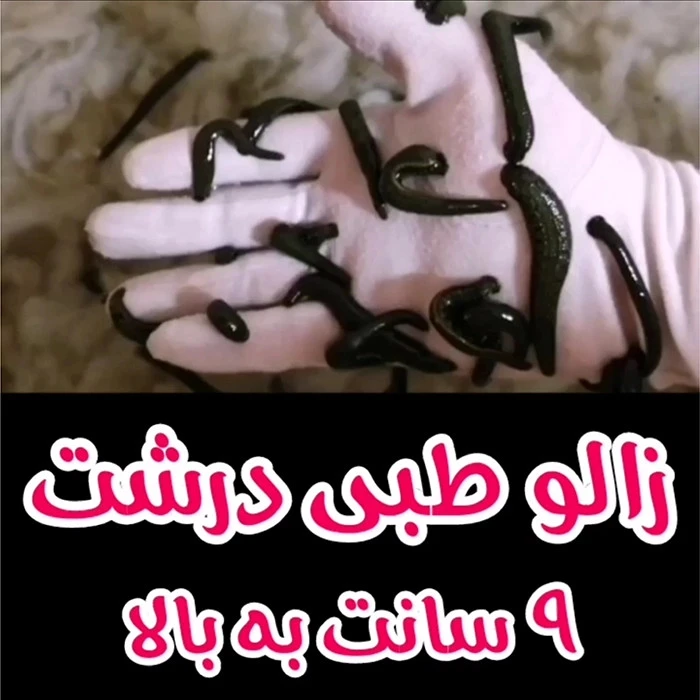 زالو طبی درشت 9 سانت به بالا تکی