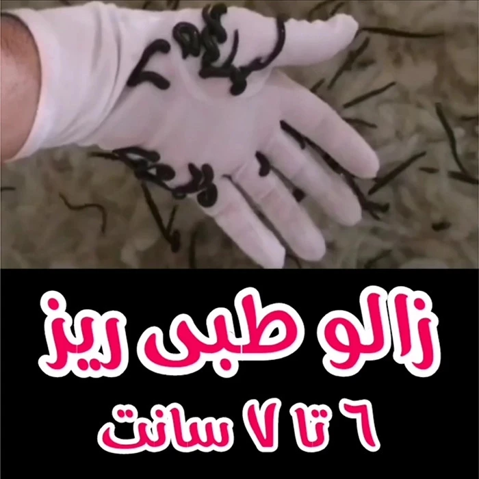 زالو طبی ریز 6تا7 سانت تکی