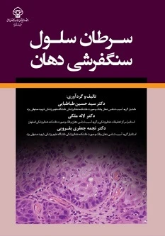 سرطان سلول سنگفرشی دهان
