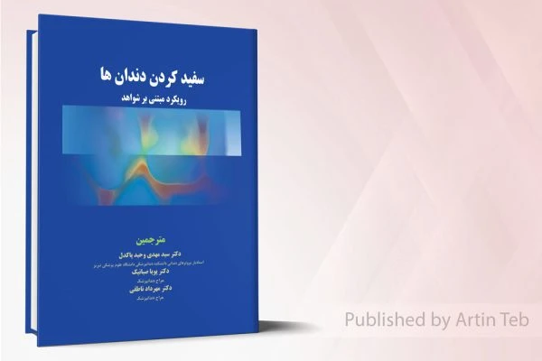 سفید کردن دندان ها – رویکرد مبتنی بر شواهد