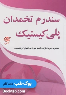 سندرم تخمدان پلی کیستیک