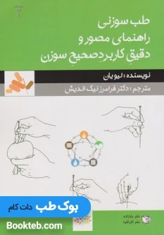 طب سوزنی راهنمای مصور و دقیق کاربرد صحیح سوزن
