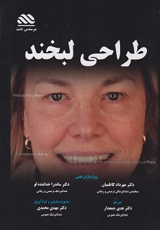 طراحی لبخند راهنمای کلینیکی برای دندانپزشکان سرامیست ها و بیماران