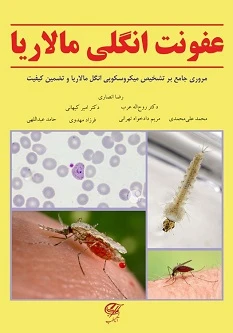 عفونت انگلی مالاریا