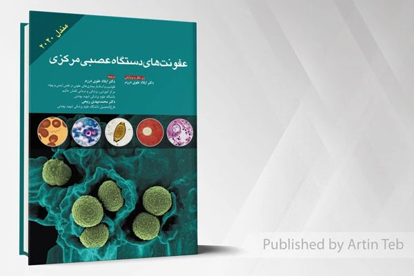 عفونت های دستگاه عصبی مرکزی (مندل 2020)