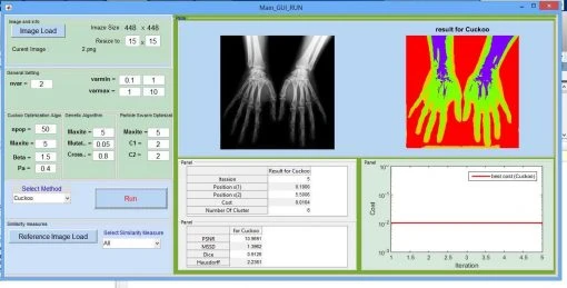 فروش پروژه شناسایی تومورهای مغزی با الگوریتم DBSCAN
