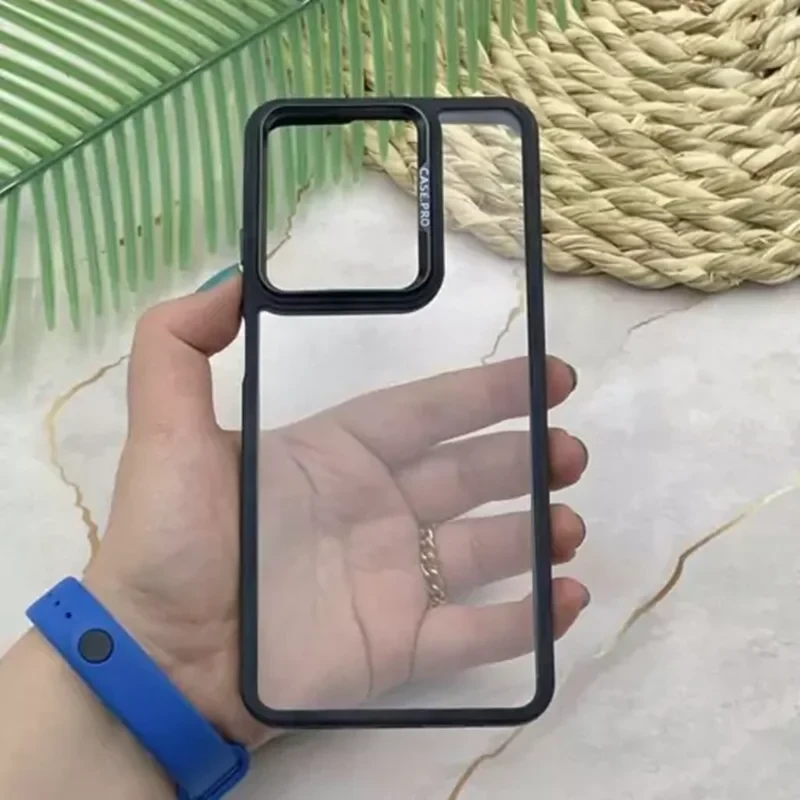 قاب نیو اسکین honor x۷A