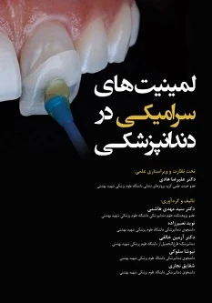 لمینیت های سرامیکی در دندانپزشکی